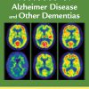 ADHD Comorbidities: Handbook for ADHD Complications in Children and Adults (PDF)