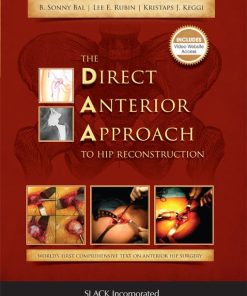 The Direct Anterior Approach to Hip Reconstruction (PDF)