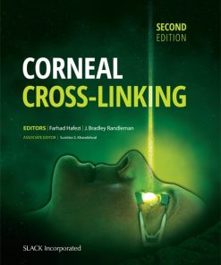 Corneal Cross-Linking, 2nd Edition (EPUB)