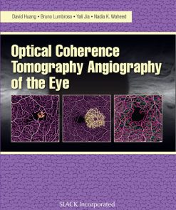 Optical Coherence Tomography Angiography of the Eye (EPUB)