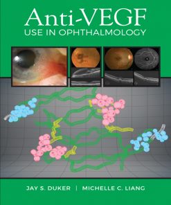 Anti-VEGF Use in Ophthalmology (EPUB)