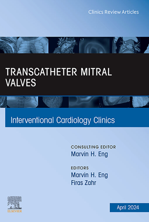 Interventional Cardiology Clinics: Volume 13 (Issue 1 to Issue 2) 2024 PDF