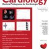 Revista Portuguesa de Cardiologia: Volume 42 (Issue 1 to Issue 12) 2023 PDF