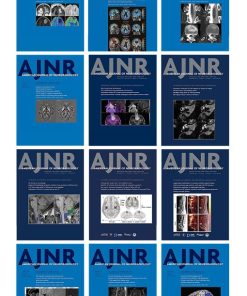 American journal of Neuroradiology 2023 Full Archives (PDF)