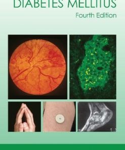 Atlas of Diabetes Mellitus, 4th edition (PDF)