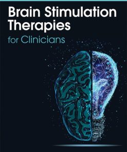 Brain Stimulation Therapies for Clinicians, 2nd Edition (EPUB)