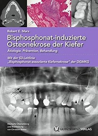 Bisphosphonat-induzierte Osteonekrose der Kiefer: Ätiologie, Prävention, Behandlung (German Edition) (EPUB)