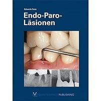 Endo-Paro-Läsionen (German Edition) (EPUB)