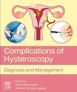 Complications of Hysteroscopy: Diagnosis and Management (PDF)