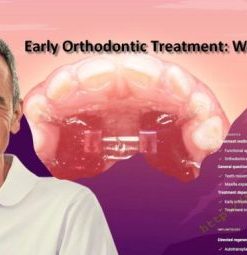 Early orthodontic treatment: when and how (Dental course)