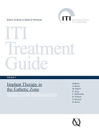 Implant Therapy in the Esthetic Zone: Single-Tooth Replacements (ITI Treatment Guide Series Book 1) (EPUB)