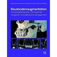 Sinusbodenaugmentation: Schwierigkeitsgrade, chirurgisches Vorgehen, Komplikationsmanagement (German Edition) (EPUB)