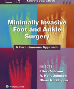 Minimally Invasive Foot and Ankle Surgery: A Percutaneous Approach (ePub+Converted PDF)