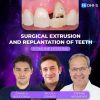 OHI-S Surgical Extrusion and Replantation of Teeth (Dental course)