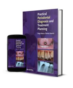 Practical Periodontal Diagnosis and Treatment Planning, 2nd edition (PDF)