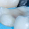 The Baard Institute Overlay, Onlay (Dental course)