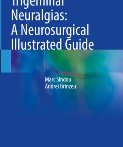 Trigeminal Neuralgias: A Neurosurgical Illustrated Guide