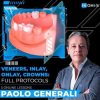 Veneers, Inlay, Onlay, Crowns: Full Protocols (Dental course)