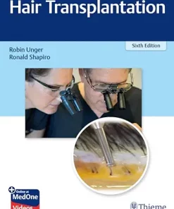 Hair Transplantation, 6th Edition (EPUB)