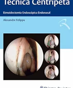 Técnica Centrípeta: Etmoidectomia Endoscópica Endonasal (Portuguese Edition) (EPUB)