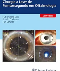 Cirurgia A Laser De Femtossegundo Em Oftalmologia (Portuguese Edition) (PDF)