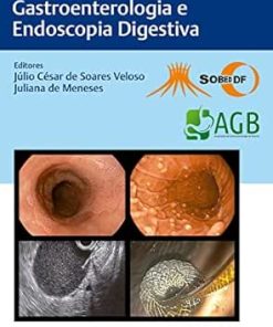 Desafios Em Gastroenterologia E Endoscopia Digestiva (Portuguese Edition) (EPUB)