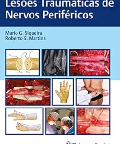 Lesões Traumáticas De Nervos Periféricos (Portuguese Edition) (EPUB)