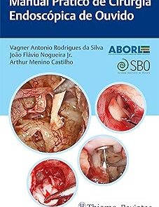 Manual Prático De Cirurgia Endoscópica De Ouvido (Portuguese Edition) (EPUB)