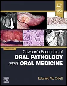 Cawson’s Essentials Of Oral Pathology And Oral Medicine, 10th Edition (EPUB)