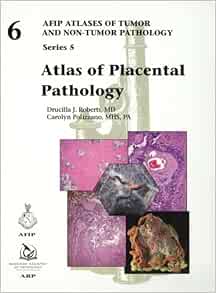 Atlas Of Placental Pathology (AFIP Atlas Of Tumor And Non-Tumor Pathology, Series 5, Volume 6) (PDF)