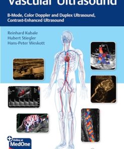 Vascular Ultrasound: B-Mode, Color Doppler And Duplex Ultrasound, Contrast-Enhanced Ultrasound (EPUB)