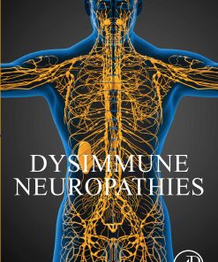 Dysimmune Neuropathies (PDF)