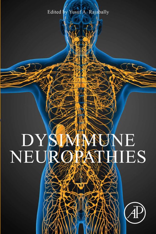 Dysimmune Neuropathies (PDF)