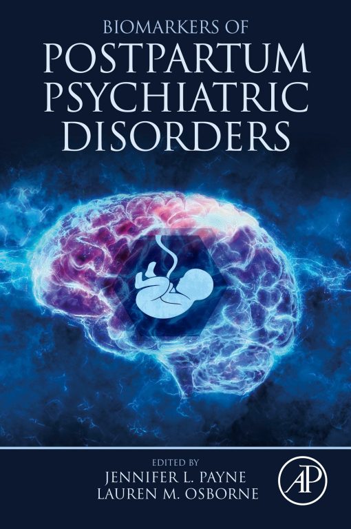 Biomarkers of Postpartum Psychiatric Disorders (PDF)