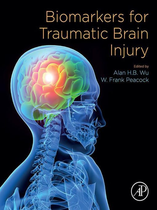 Biomarkers for Traumatic Brain Injury (EPUB)