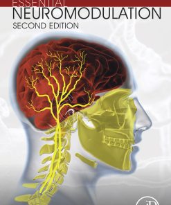 Essential Neuromodulation, 2nd Edition (EPUB)