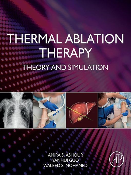 Thermal Ablation Therapy: Theory and Simulation (EPUB)