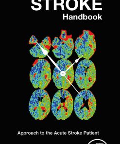 The Code Stroke Handbook: Approach to the Acute Stroke Patient (EPUB)