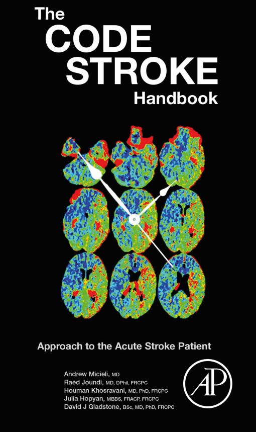 The Code Stroke Handbook: Approach to the Acute Stroke Patient (EPUB)