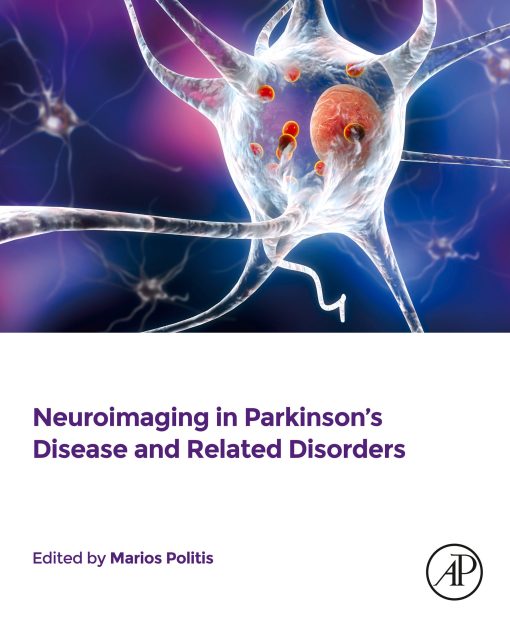 Neuroimaging in Parkinson’s Disease and Related Disorders (EPUB)