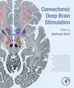 Connectomic Deep Brain Stimulation (EPUB)