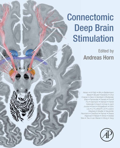 Connectomic Deep Brain Stimulation (EPUB)