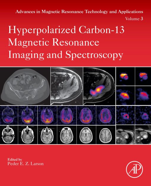 Hyperpolarized Carbon-13 Magnetic Resonance Imaging And Spectroscopy (PDF)