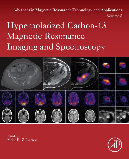 Hyperpolarized Carbon-13 Magnetic Resonance Imaging And Spectroscopy (EPUB)