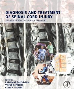 Diagnosis and Treatment of Spinal Cord Injury (EPUB)