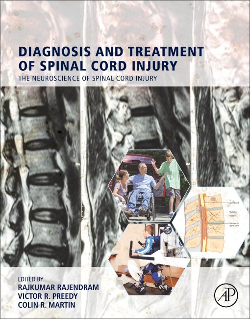 Diagnosis and Treatment of Spinal Cord Injury (EPUB)