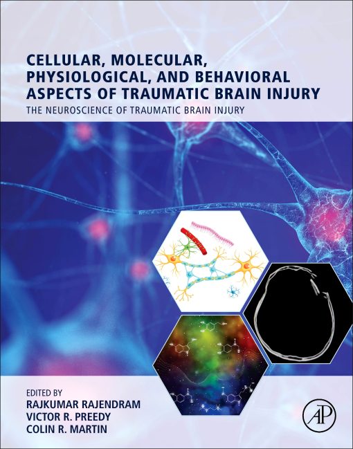 Cellular, Molecular, Physiological, and Behavioral Aspects of Traumatic Brain Injury (EPUB)