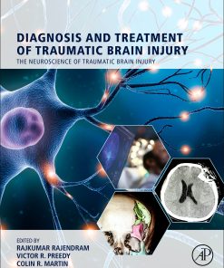 Diagnosis and Treatment of Traumatic Brain Injury (EPUB)