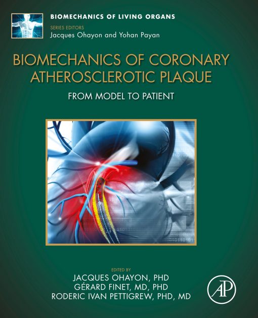 Biomechanics of Coronary Atherosclerotic Plaque: From Model to Patient (EPUB)