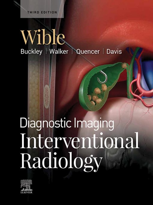 Diagnostic Imaging: Interventional Radiology, 3rd Edition (EPUB)